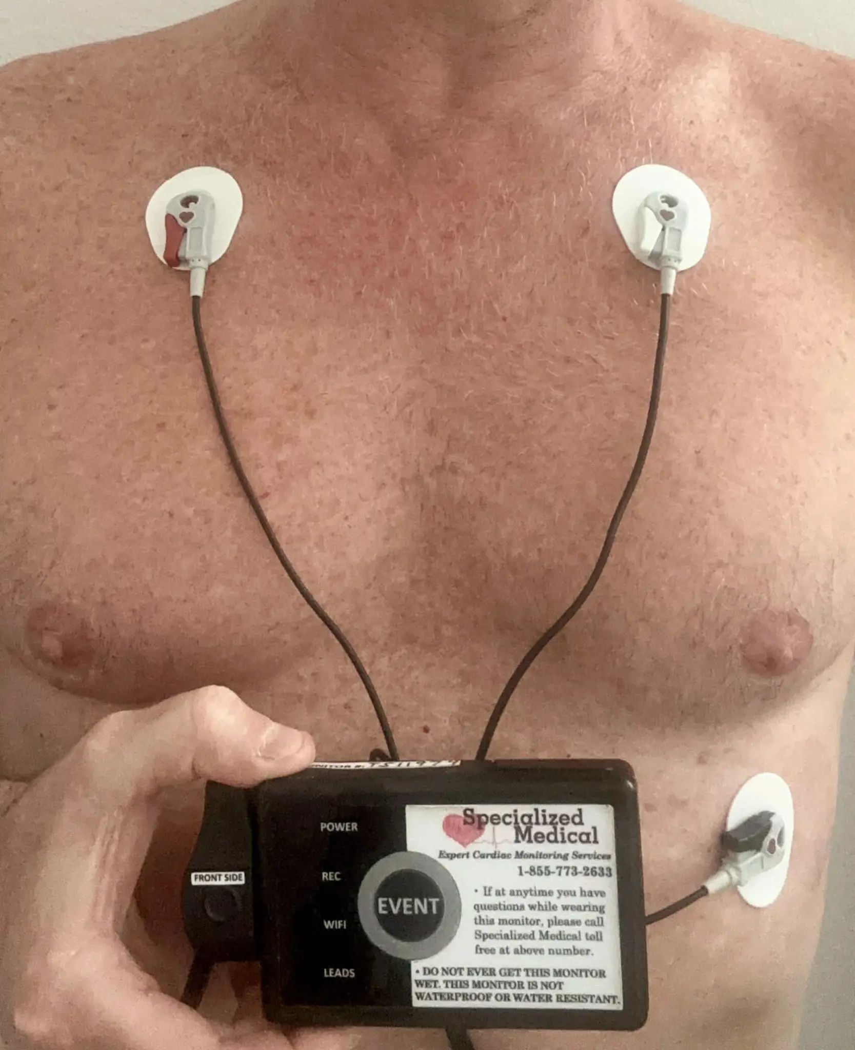 Cardiac event monitor device held by patient showing Specialized Medical branding and event button